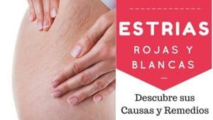 Causas de las estrías: estiramiento de la piel y alteraciones del colágeno