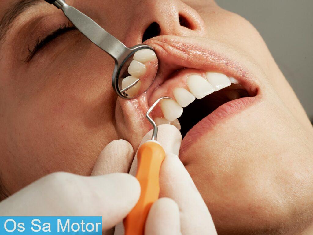 Beneficios de la periodoncia