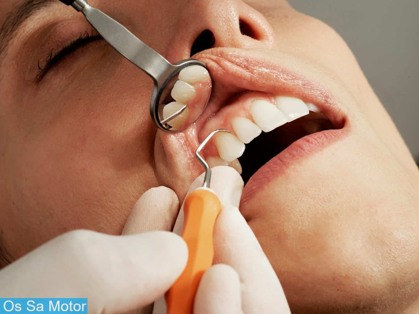 Beneficios de la periodoncia