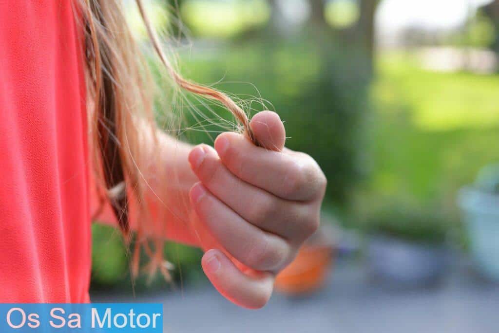hair loss