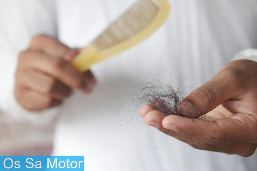 hair loss