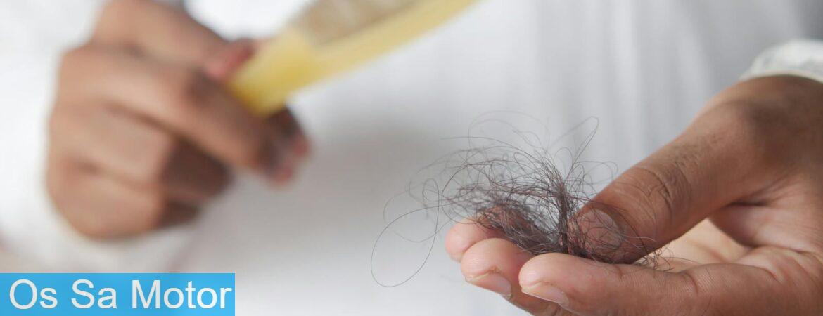 hair loss