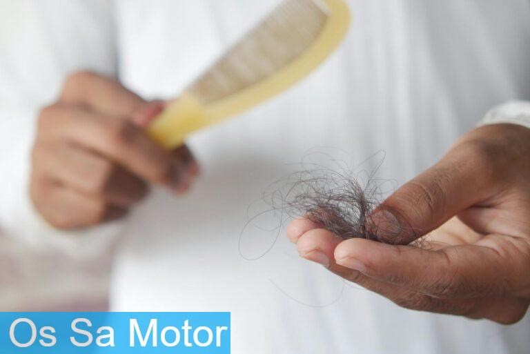 Recomendaciones para evitar la caída del cabello