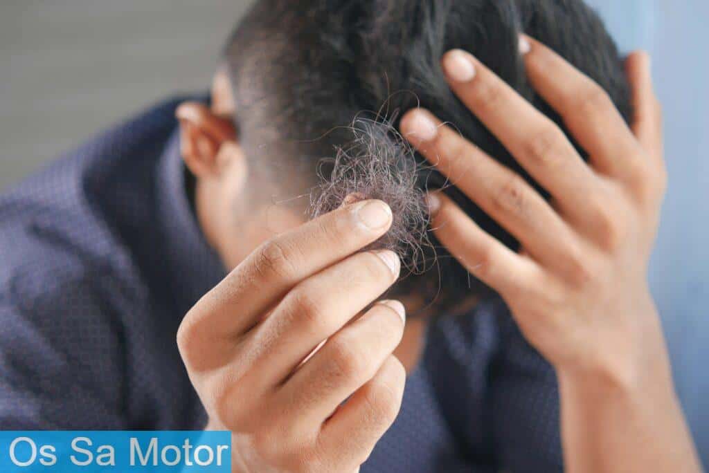 hair loss
